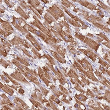 Anti-UQCRQ antibody produced in rabbit Prestige Antibodies&#174; Powered by Atlas Antibodies, affinity isolated antibody, buffered aqueous glycerol solution