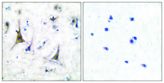 Anti-PGP9.5 antibody produced in rabbit affinity isolated antibody