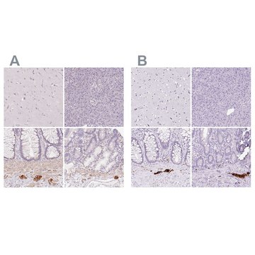 Anti-PRPH antibody produced in rabbit Prestige Antibodies&#174; Powered by Atlas Antibodies, affinity isolated antibody, buffered aqueous glycerol solution