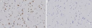 Anti-CHD2 Antibody, clone 2J13 ZooMAb® Rabbit Monoclonal recombinant, expressed in HEK 293 cells