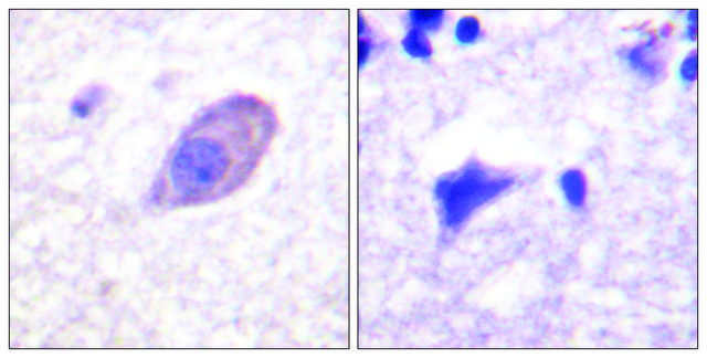 Anti-Kir5.1 antibody produced in rabbit affinity isolated antibody