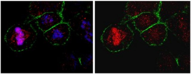 Anti-CKAP5 Antibody from rabbit, purified by affinity chromatography