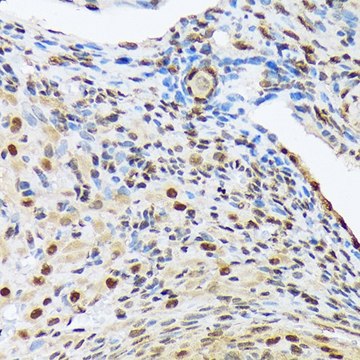 Anti-HES5 antibody produced in rabbit