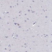 Anti-CAPNS2 Prestige Antibodies® Powered by Atlas Antibodies, affinity isolated antibody