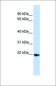 Anti-TMED1 antibody produced in rabbit affinity isolated antibody