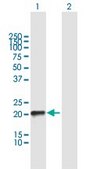 Anti-RHOQ antibody produced in mouse purified immunoglobulin, buffered aqueous solution