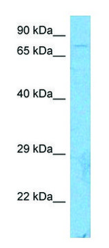 Anti-CUL3 (C-terminal) antibody produced in rabbit affinity isolated antibody