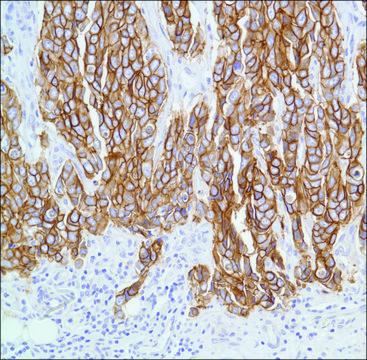 Anti-C-ERBB-2/HER-2 antibody, Rabbit monoclonal recombinant, expressed in proprietary host, clone SP3, tissue culture supernatant