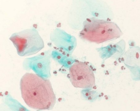 Shorr staining solution for hormonal cytodiagnosis