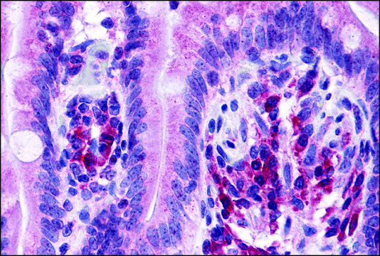 Anti-ANKRD27 antibody produced in rabbit affinity isolated antibody