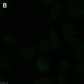 Anti-Rabies glycoprotein Antibody, clone 24-3F-10 ZooMAb® Mouse Monoclonal recombinant, expressed in HEK 293 cells