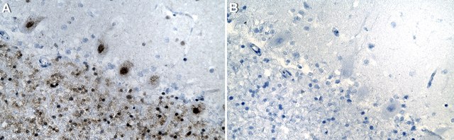 Anti-CUX1 Antibody, clone 1J18 ZooMAb&#174; Rabbit Monoclonal recombinant, expressed in HEK 293 cells