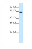 Anti-SLC33A1 antibody produced in rabbit affinity isolated antibody