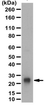 Anti-Protein Gene Product 9.5 Antibody from rabbit, purified by affinity chromatography