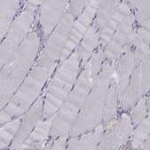 Anti-PAX2 antibody produced in rabbit Prestige Antibodies® Powered by Atlas Antibodies, affinity isolated antibody