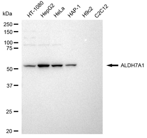 Anti ALDH7A1 Antibody, clone 23GB4310, Rabbit Monoclonal clone 23GB4310, recombinant rabbit monoclonal, expressed in HEK293 cells