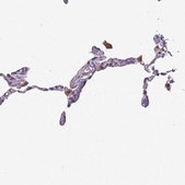 Anti-JAML antibody produced in rabbit Prestige Antibodies® Powered by Atlas Antibodies, affinity isolated antibody, buffered aqueous glycerol solution