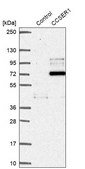 Anti-CCSER1 antibody produced in rabbit Prestige Antibodies® Powered by Atlas Antibodies, affinity isolated antibody, buffered aqueous glycerol solution