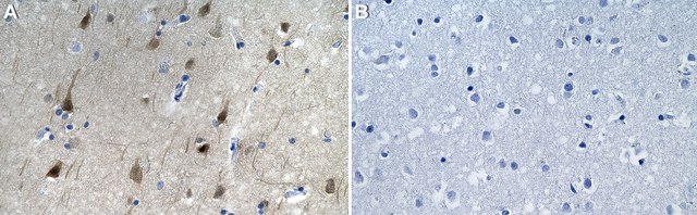 Anti-Cdk5 Antibody, clone 1H13 ZooMAb&#174; Rabbit Monoclonal recombinant, expressed in HEK 293 cells