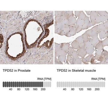 抗-TPD52 兔抗 Prestige Antibodies&#174; Powered by Atlas Antibodies, affinity isolated antibody, buffered aqueous glycerol solution