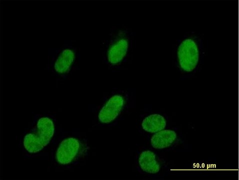 Anti-SMARCE1 antibody produced in mouse purified immunoglobulin, buffered aqueous solution