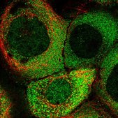 Anti-TLDC1 antibody produced in rabbit Prestige Antibodies® Powered by Atlas Antibodies, affinity isolated antibody, buffered aqueous glycerol solution