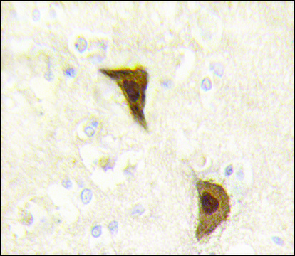 Anti-CYP26A1 (center) antibody produced in rabbit saturated ammonium sulfate (SAS) precipitated, buffered aqueous solution