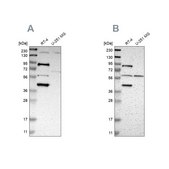Anti-C1orf116 antibody produced in rabbit Prestige Antibodies® Powered by Atlas Antibodies, affinity isolated antibody, buffered aqueous glycerol solution
