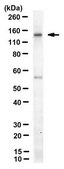 Anti-CP110 Antibody, clone 140-195-5 clone 140-195-5, from mouse