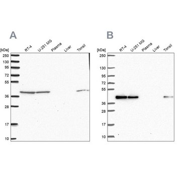 Anti-IDH3B antibody produced in rabbit Prestige Antibodies&#174; Powered by Atlas Antibodies, affinity isolated antibody, buffered aqueous glycerol solution