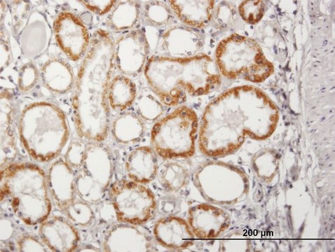 Anti-ACADM antibody produced in mouse purified immunoglobulin, buffered aqueous solution