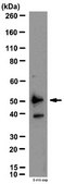 Anti-VPAC2 Antibody from rabbit, purified by affinity chromatography