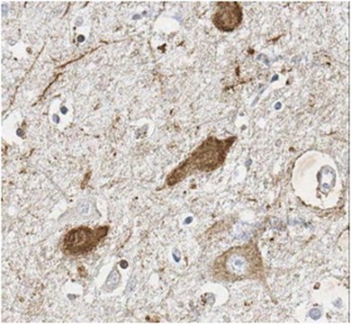 Anti-MAGL Antibody from rabbit, purified by affinity chromatography