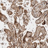 Anti-OTUD6B antibody produced in rabbit Prestige Antibodies® Powered by Atlas Antibodies, affinity isolated antibody, buffered aqueous glycerol solution