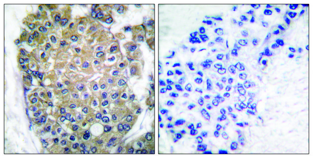 Anti-Keratin 17 antibody produced in rabbit affinity isolated antibody