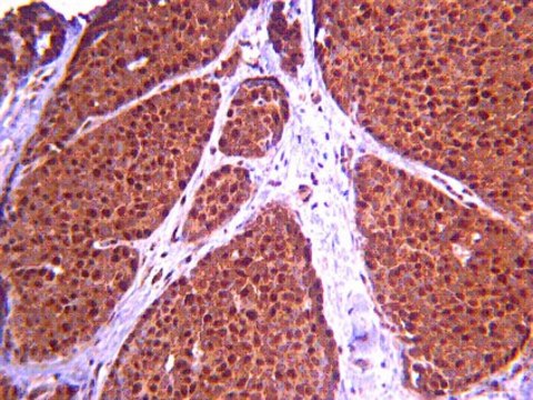 Anti-ASPM Antibody from rabbit, purified by affinity chromatography