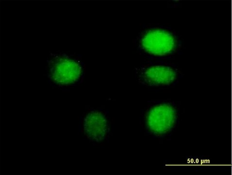 Anti-ARNT antibody produced in mouse purified immunoglobulin, buffered aqueous solution