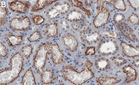 Anti-PKR Antibody, clone 2H14 ZooMAb® Rabbit Monoclonal recombinant, expressed in HEK 293 cells