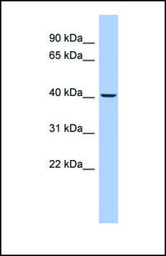 Anti-PRKACB antibody produced in rabbit affinity isolated antibody