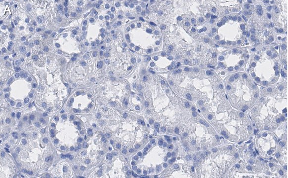 Anti-VDAC1 Antibody, clone 3M22, ZooMAb&#174; Rabbit Monoclonal recombinant, expressed in HEK 293 cells