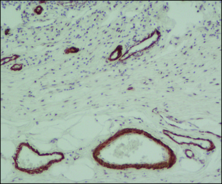 Monoclonal Anti-Actin, &#945;-Smooth Muscle - Peroxidase antibody produced in mouse clone 1A4, purified from hybridoma cell culture