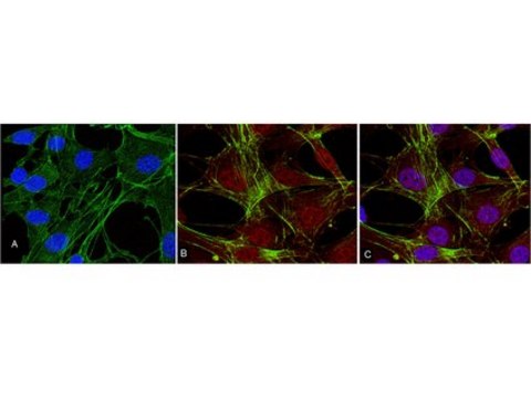 Anti-phospho-Akt (Thr308) Antibody, clone 50-1C-25, rabbit monoclonal clone NL50, Upstate&#174;, from rabbit