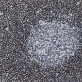 Anti-SP100 antibody produced in rabbit Prestige Antibodies® Powered by Atlas Antibodies, affinity isolated antibody, buffered aqueous glycerol solution