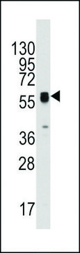 ANTI-ECGF1 (CENTER) antibody produced in rabbit affinity isolated antibody, buffered aqueous solution