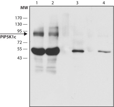 Anti-PIP5K1C (C-terminal) antibody produced in rabbit ~1.5&#160;mg/mL, affinity isolated antibody, buffered aqueous solution