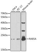 Anti-RAB5A antibody produced in rabbit