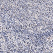 Anti-ABCC2 antibody produced in rabbit Prestige Antibodies® Powered by Atlas Antibodies, affinity isolated antibody, buffered aqueous glycerol solution, Ab2