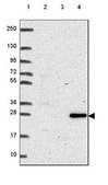 Anti-RNASET2 antibody produced in rabbit Prestige Antibodies® Powered by Atlas Antibodies, affinity isolated antibody, buffered aqueous glycerol solution