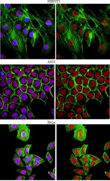 Anti-U1-70K Antibody from rabbit