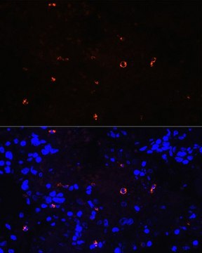 Anti-Lysozyme (LYZ) antibody produced in rabbit